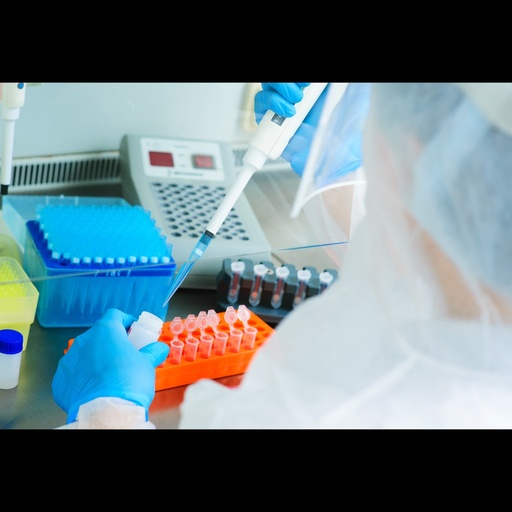 [0743-PDPS-AR114] Tick borne Encephalitis Virus ''TBEV'' Real Time RT PCR Assay   50 Reactions